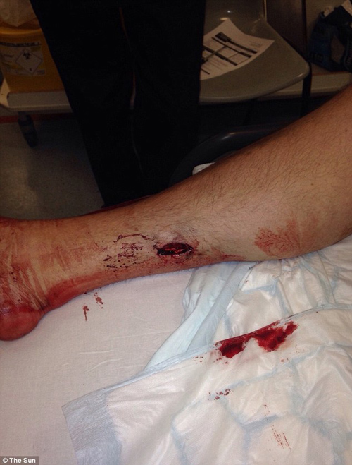 ����ĸ��½������������ӵ��Ȳ��ճ��ѿڡ�