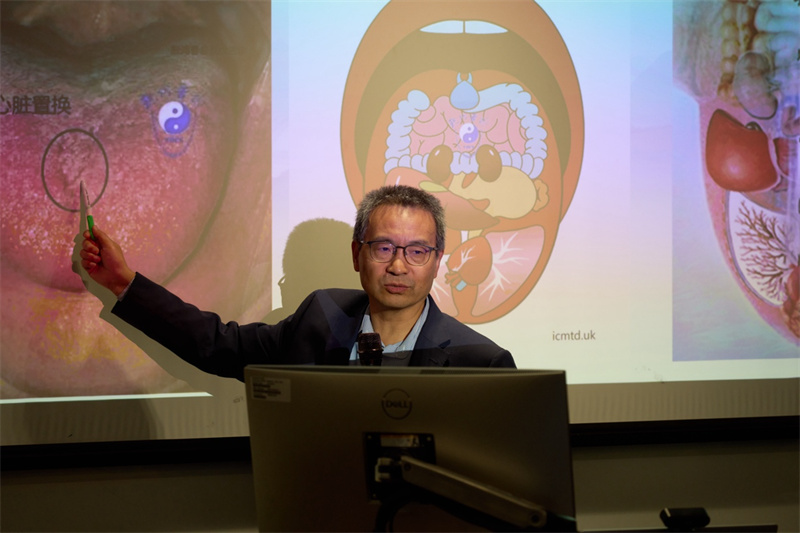 英国中医师学会学术委员会副主席殷鸿春做舌诊分享。杨浩鹏摄
