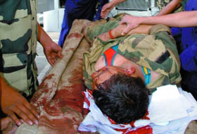 ��ѡ������Ϯ��17������